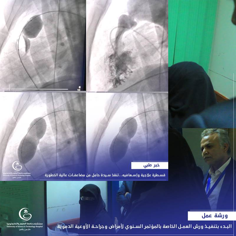 في حالة فريدة من نوعها.. قسطرة علاجية وإسعافيه.. تنقذ سيدة حامل من مضاعفات عالية الخطورة 